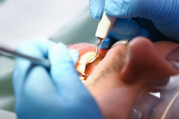 Best Broken Tooth Emergency  in Troutman, NC