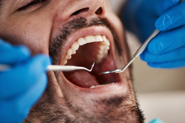 Best Dentist for Tooth Abscess  in Troutman, NC