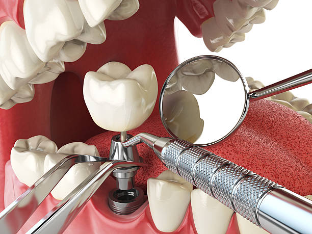 Best Cracked Tooth Emergency Dentist  in Troutman, NC